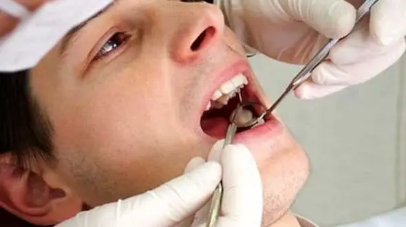 علت اصلی دو سرطان شایع سلامت بد دهان است