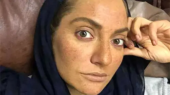 نخستین تصاویر از پشت صحنه شاه کش منتشر شد +فیلم