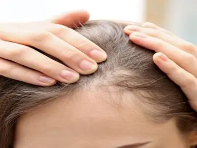 عادت‌ هایی که بی‌ صدا موهای زنان را کم‌ پشت می‌ کنند