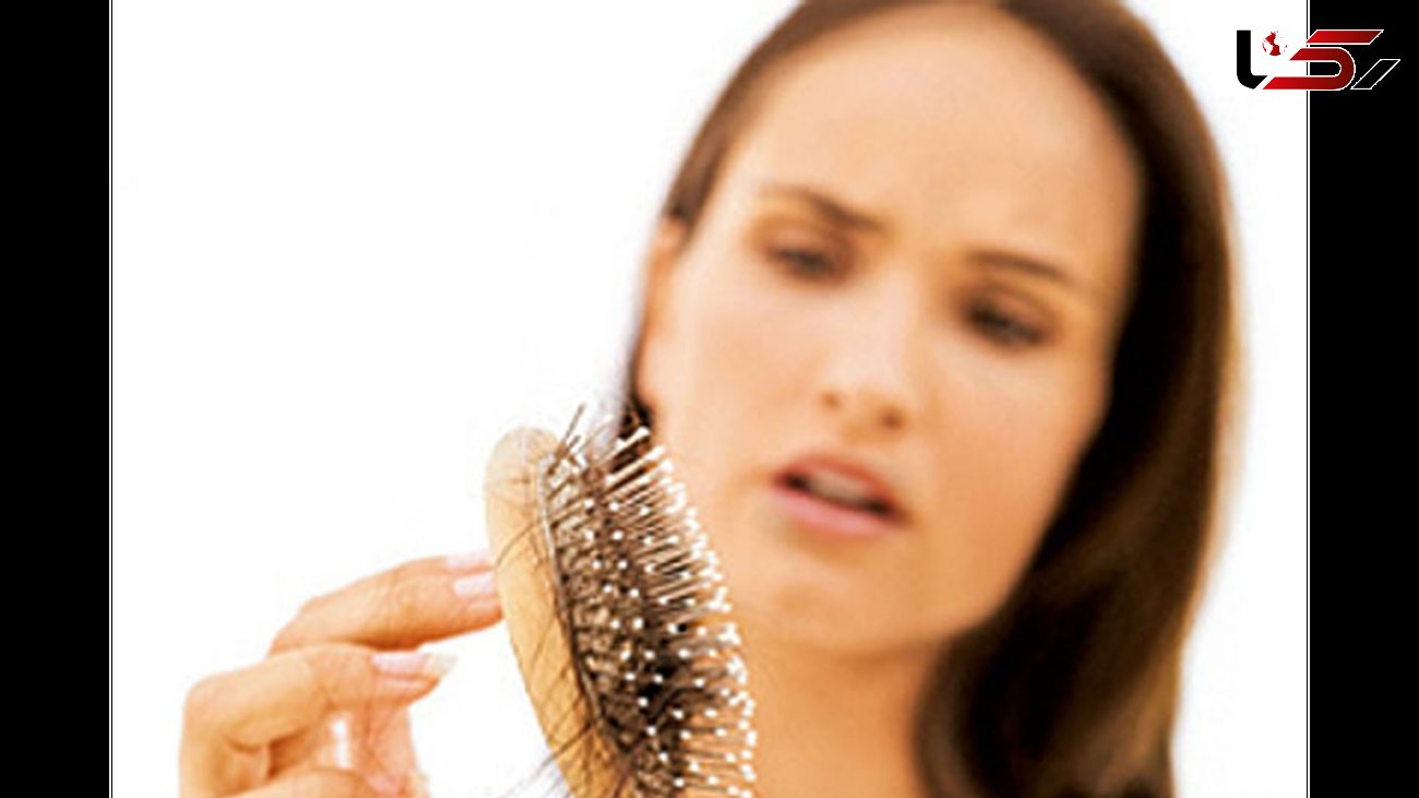 ارتباط کاهش وزن با ریزش موی شدید