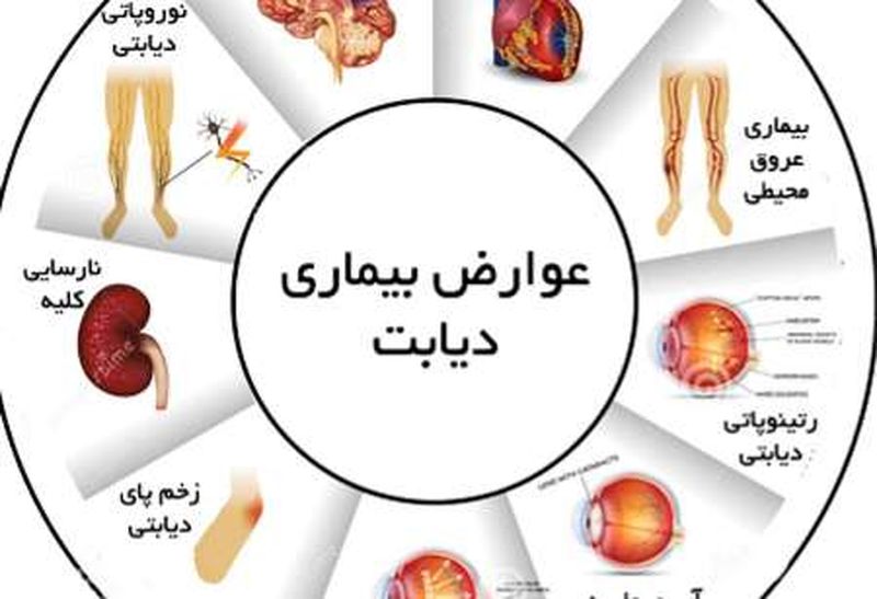 عوارض دیابت