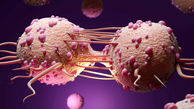 3 کار ساده و مهم برای مهار سلول های سرطانی + فیلم