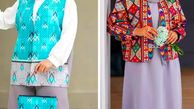 مانتو طرحدار تابستانی؛ 15 انتخاب جذاب برای استایل بانوان