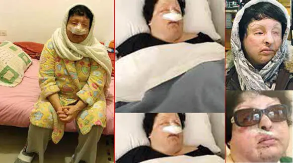 آخرین وضعیت آمنه / کم مانده بود بمیرم