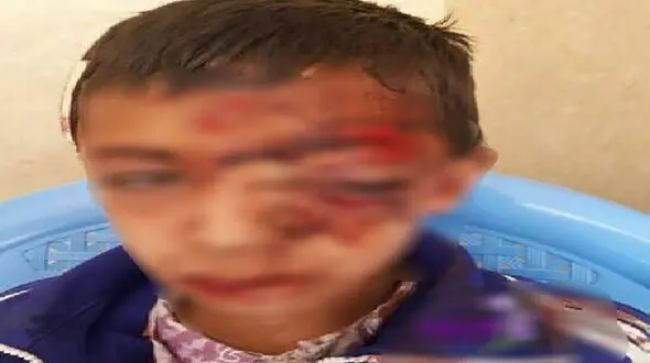  سقوط هولناک دانش‌آموز قاینی از کوه به خاطر اینترنت ضعیف + عکس