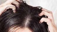 راهکارهای طلایی برای مقابله با موهای چرب