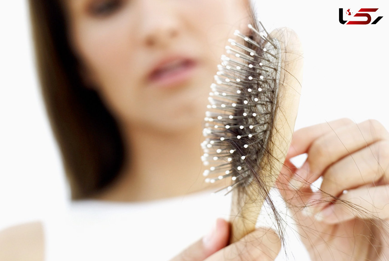 خرافات عامل ریزش موی زنان