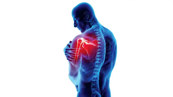 سندرم فیبرومیالژیا چیست ؟ + راه های درمان