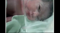 عجیب ترین حاملگی یک زن ایرانی / شوک هنگام زایمان در بیمارستان + فیلم و عکس