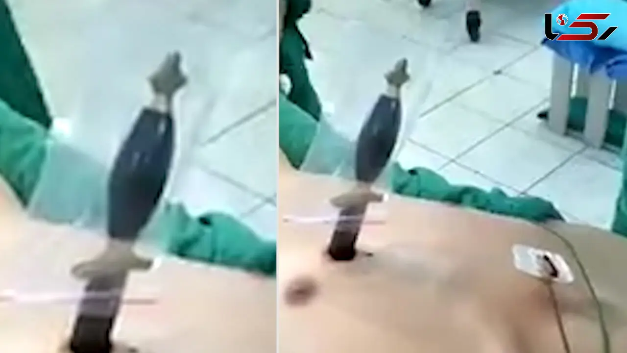 چاقو تا دسته در قلب این مرد فرو رفت ! + فیلم عجیب 16+
