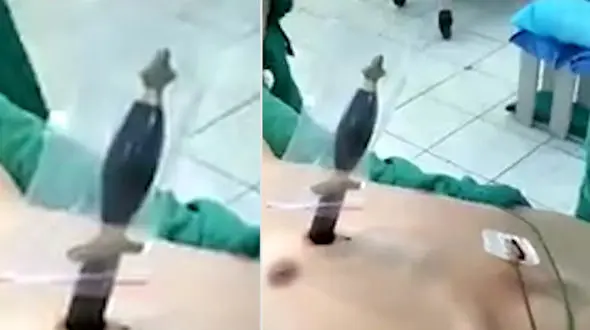 چاقو تا دسته در قلب این مرد فرو رفت ! + فیلم عجیب 16+