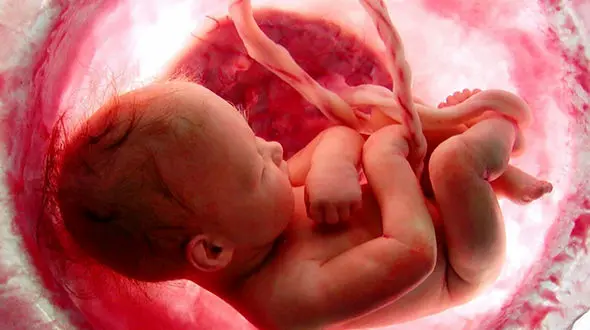 خونریزی در دوران بارداری