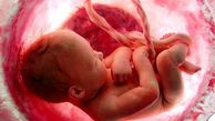 تاثیر کرونا بر جنین / پاسخ به نگرانی مادران باردار