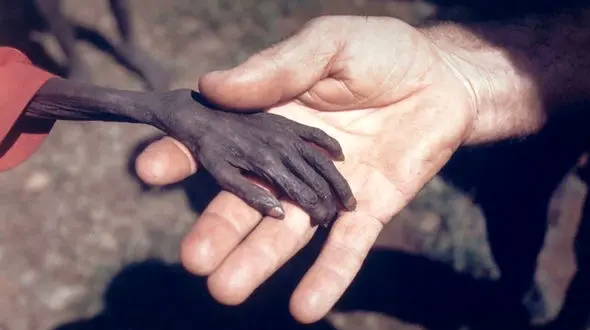 این عکس جهان را تکان داد ! + دست گرسنه ای که جهانی شد !