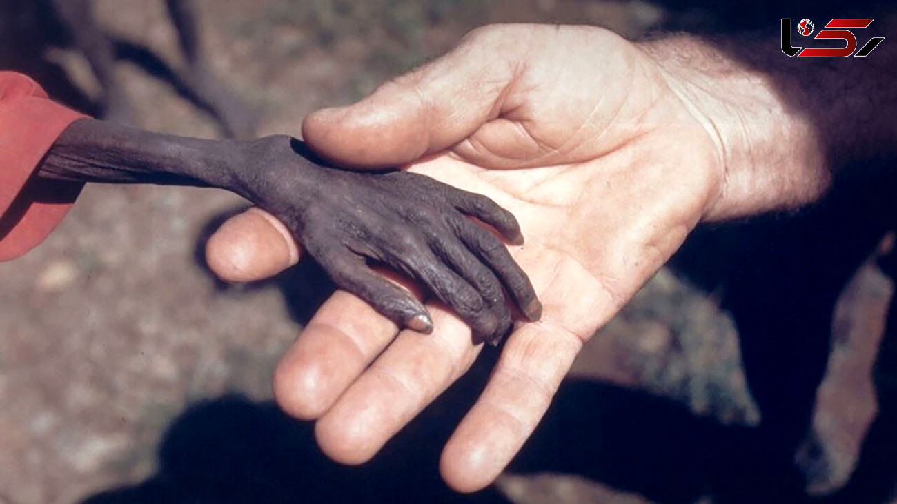 این عکس جهان را تکان داد ! + دست گرسنه ای که جهانی شد !