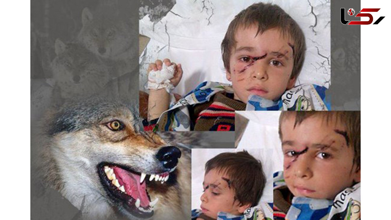  حمله 2 گرگ به 10 کودک روستایی در تبریز / پسر جوان برادر 4 ساله اش را از دندانهای گرگ بیرون کشید+تصاویر مجروحان
