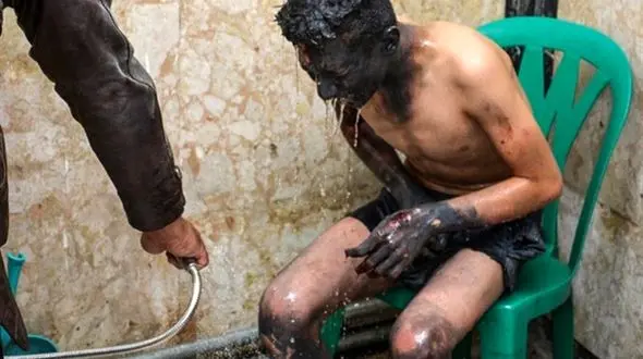 اولین عکس های دلخراش  حوادث چهارشنبه سوزی  + تصاویر