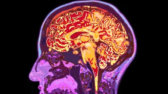 دوست و دشمن مغزتان را بشناسید