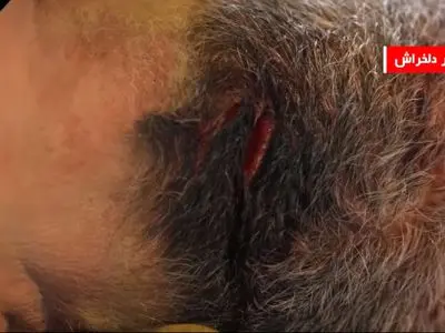 فیلم عمق فاجعه در پزشکی قانونی کهریزک تهران / حاوی صحنه های دلخراش از اجساد کشته شدگان حوادث اخیر