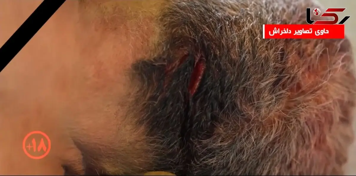 فیلم عمق فاجعه در پزشکی قانونی کهریزک تهران / حاوی صحنه های دلخراش از اجساد کشته شدگان حوادث اخیر