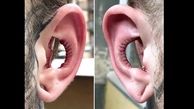 جراحی عجیب زیبایی گوش / این پسر می خواهد فالوورهایش را زیاد کند +عکس