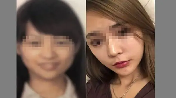  جراحی زیبایی دختر جوان را در فرودگاه به دردسر انداخت + تصاویر 