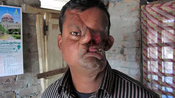 چهره وحشتناک ماهیگیر بعد از حمله یک ببر + فیلم و تصاویر (14+)