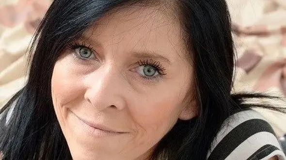 دختر ۲۰ ساله ای که ناگهان ۴۰ سال پیر شد! +تصاویر