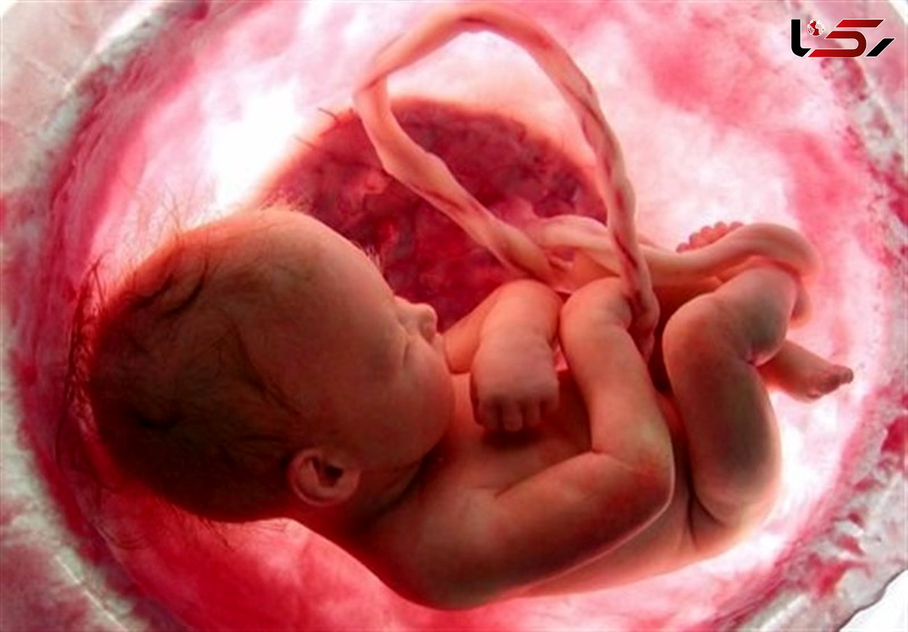 کاهش ۱۲ درصدی مجوز سقط جنین در لرستان