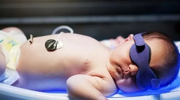 فوت نوزاد ۱۳ ماهه درپی بازیگوشی دو کودک در تنکابن