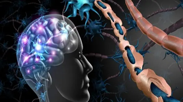 چرا ام‌ اس در زنان دو برابر مردان است؟ راه‌ های مقابله و افزایش آگاهی