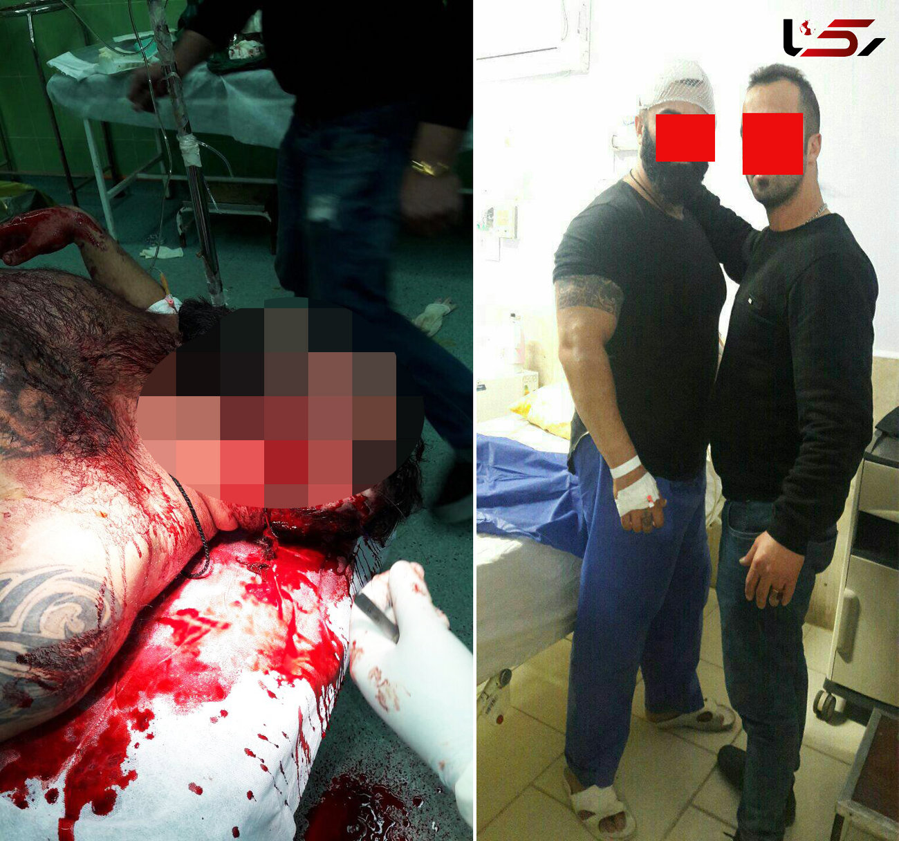 حمله با قمه به بدل شاه مازندران، او را در زندان به دردسر انداخت +عکس