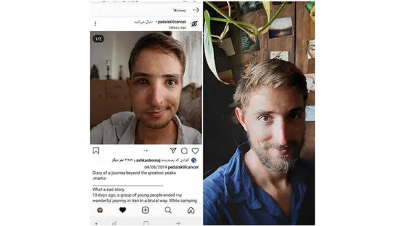 عکس چشم بادکرده مرد آلمانی که در ایران کتک خورد + جزییات