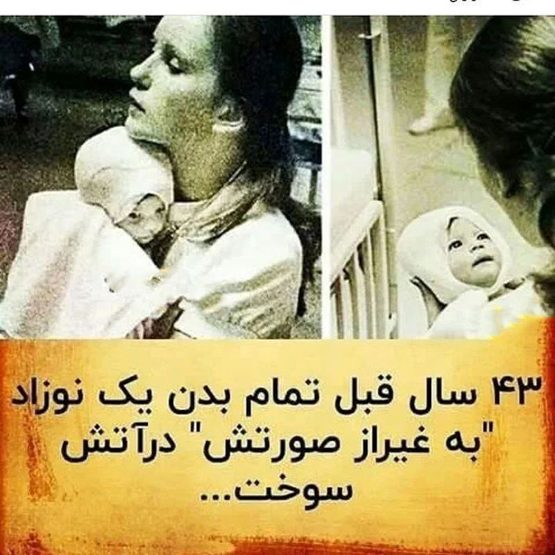 داستان این پرستار و نوزاد در جهان ماندگار شد+ عکس ها و سرنوشت