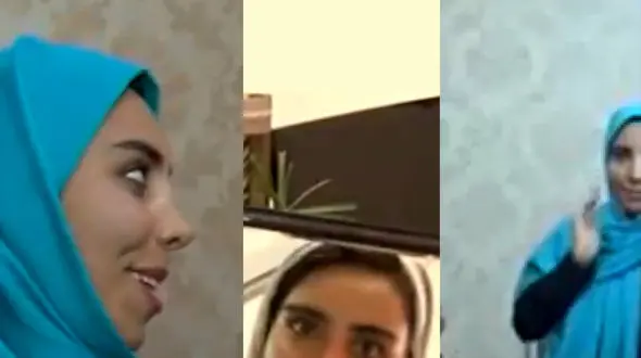 فیلم معجزه جراحی پلاستیک در صورت دختر ایرانی ! / زیبایی صورت له شده در تصادف !