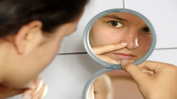 درمان های خانگی از بین بردن جوش صورت