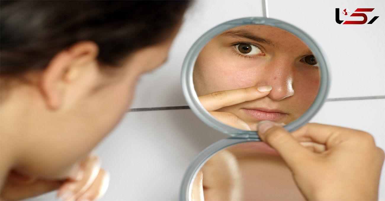 درمان های خانگی از بین بردن جوش صورت