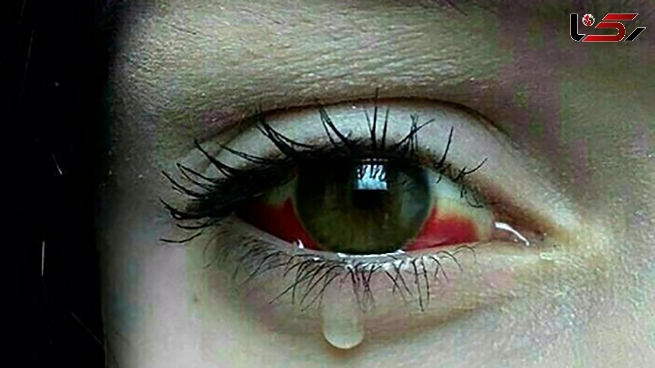 عکس گران ترین گریه دنیا  دلتان را می لرزاند ! / اوج فقر و انسانیت را ببینید !
