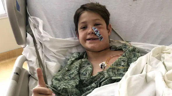 فرو رفتن سیخ کباب به جمجمه پسر 10 ساله ! + عکس