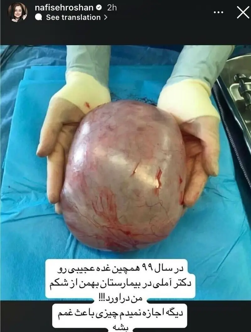 غده سرطانی