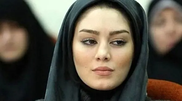 بلای که عمل زیبایی بر سر خانم بازیگر  آورد