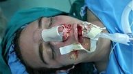 چرا زنان مرتب جراحی زیبایی  می‌کنند 