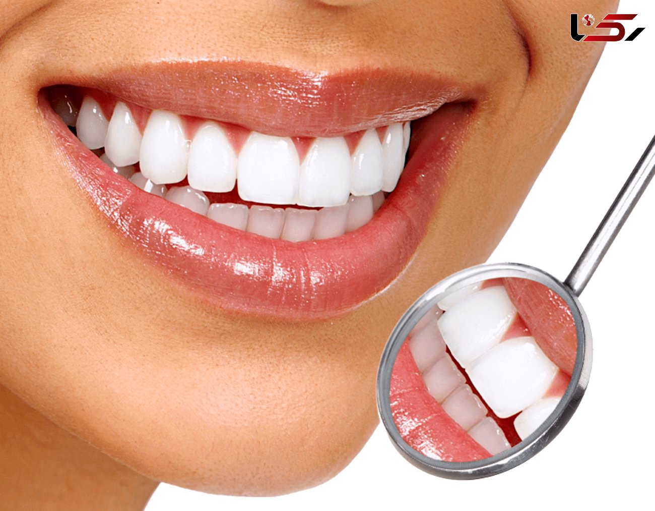 جرم گیری دندان مفید یا مضر؟