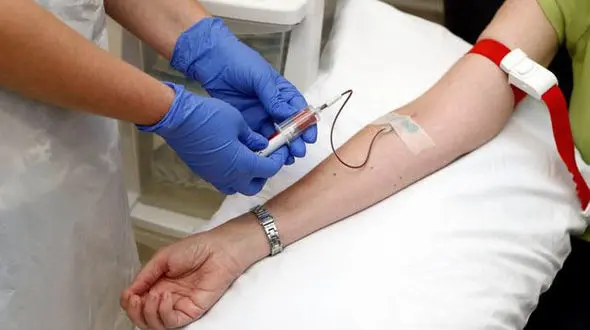 شناسایی آلزایمر با یک آزمایش خون ساده