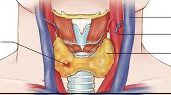 یک تکنیک عالی برای مرگ خلط پشت گلو / فیلم
