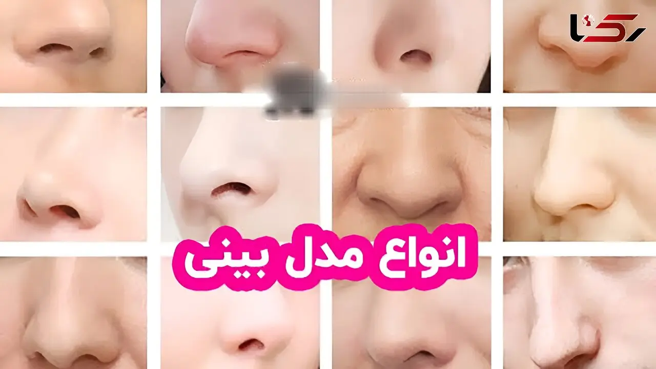 انواع مدل‌ های بینی + پاسخ به سوالات متداول درباره عمل بینی