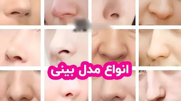 انواع مدل‌ های بینی + پاسخ به سوالات متداول درباره عمل بینی