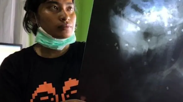 دستگیری ۴ کشاورز اندونزیایی به اتهام کشتن یک اورانگوتان + عکس 