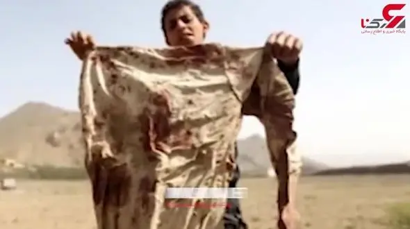 جنگ یمن؛ جنگی علیه کودکان + فیلم 