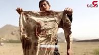 جنگ یمن؛ جنگی علیه کودکان + فیلم 